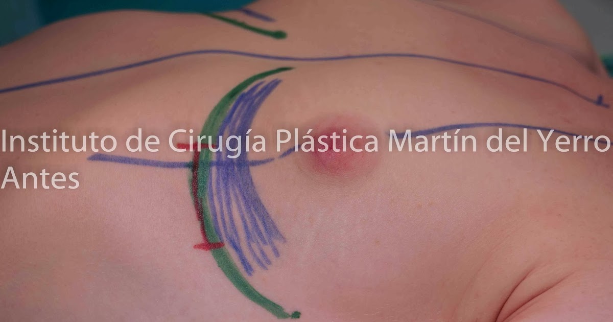 La crema para el pecho con la glicerina